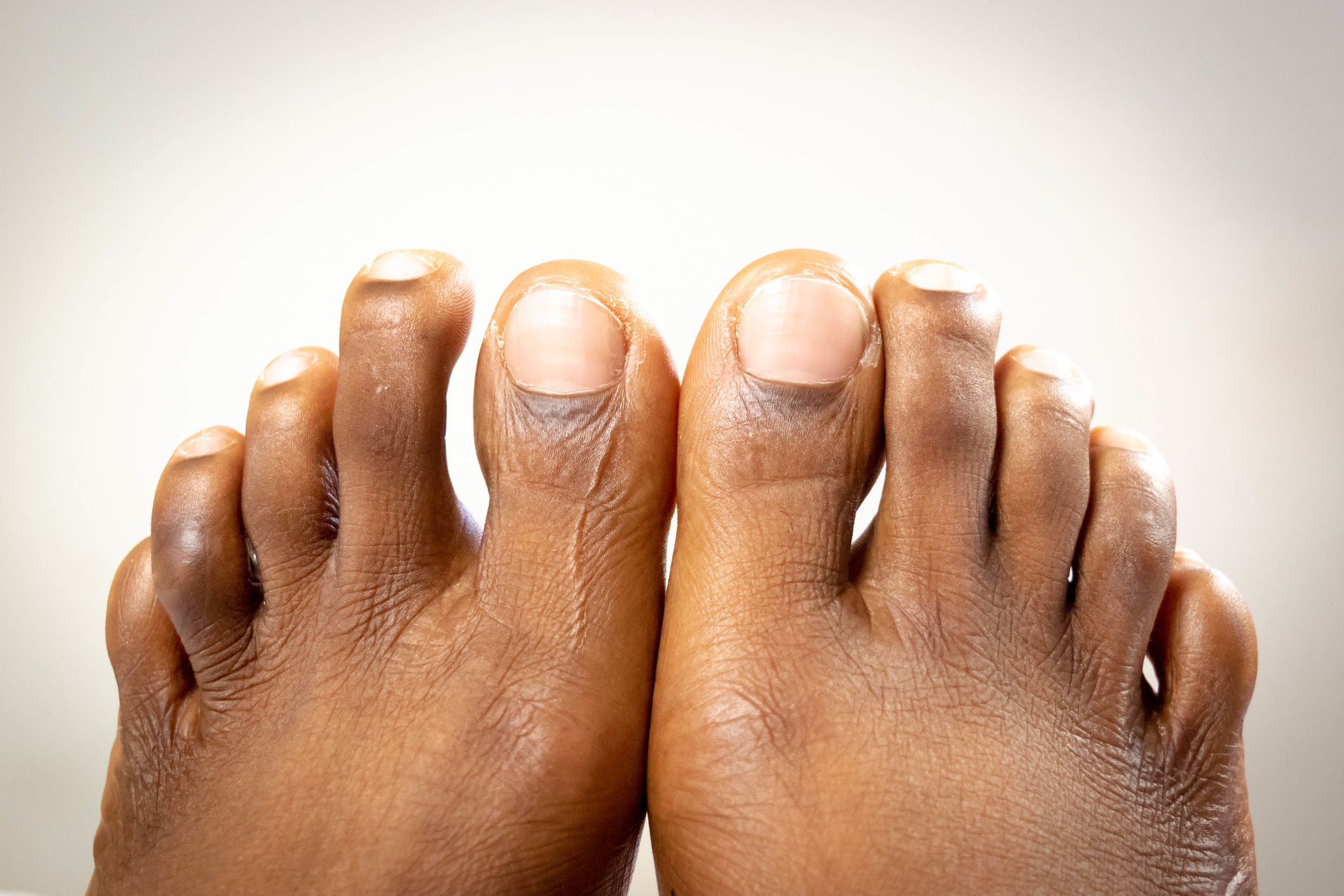 Feet